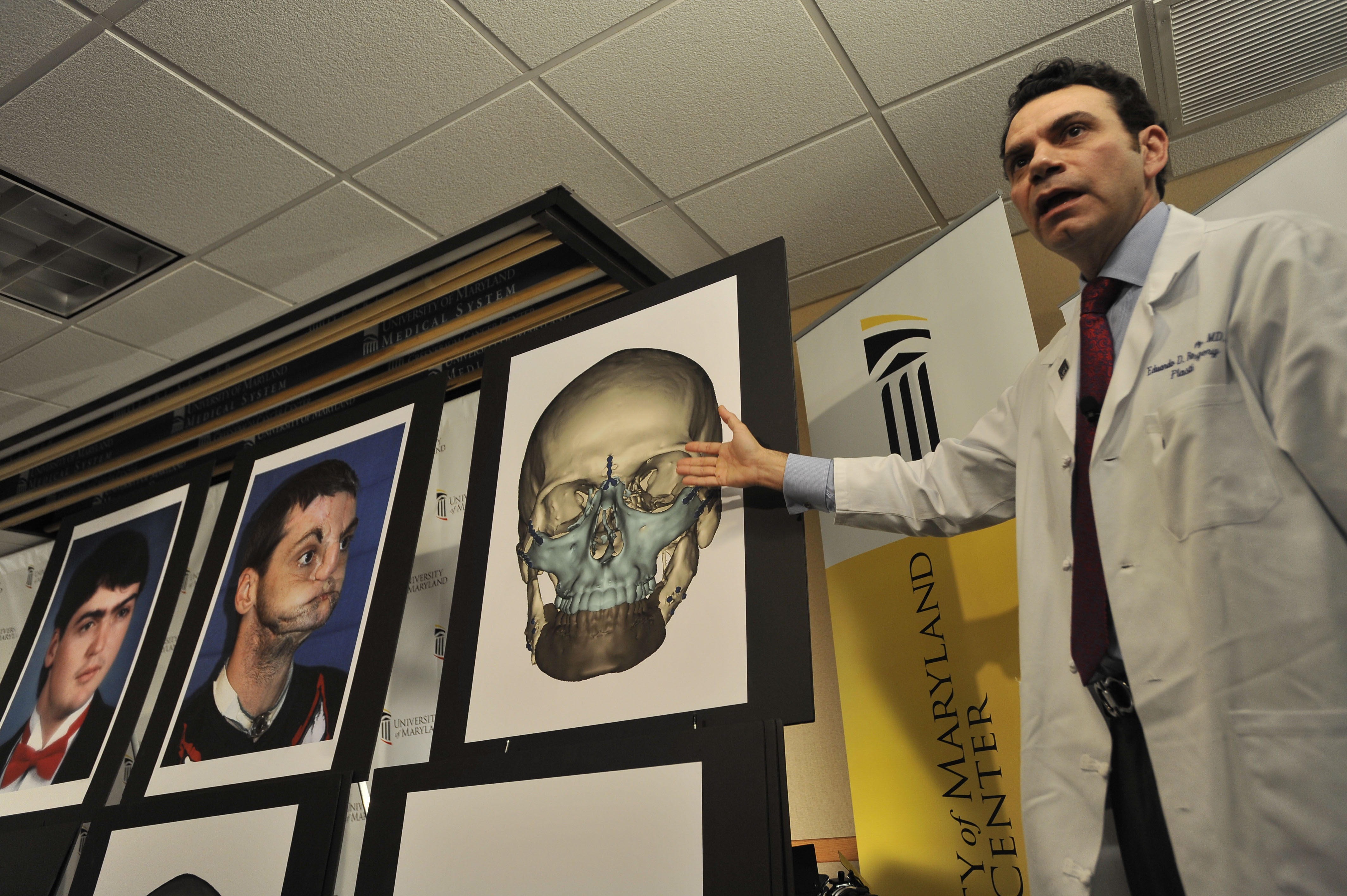 Eduardo D. Rodriguez, chefkirurgen visar upp Lee Norris skalle. 