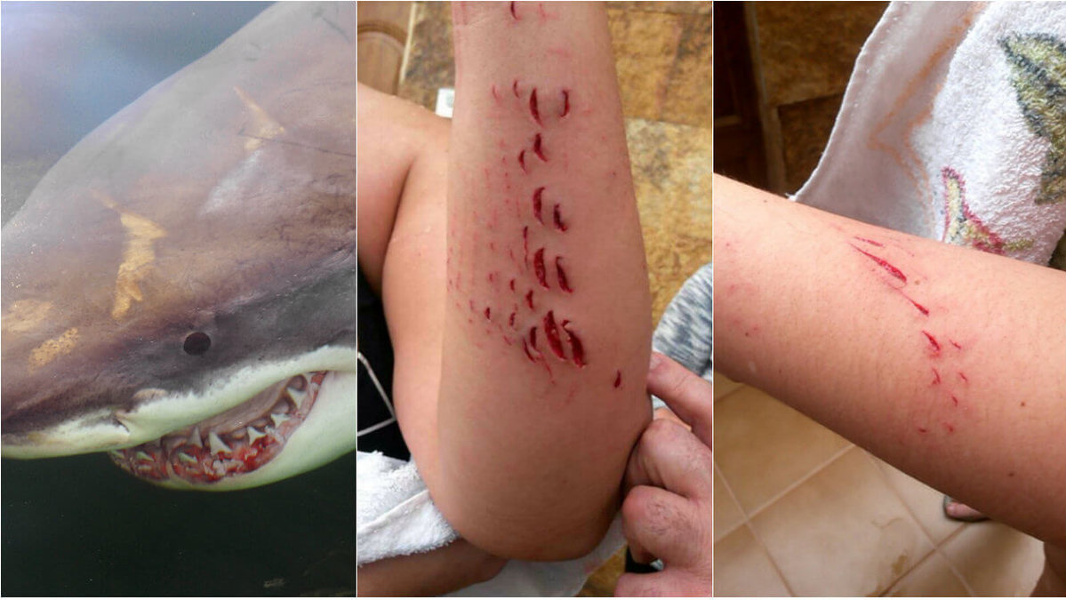 Hon simmade bara några meter från stranden när hon blev biten i armen av en haj. Obs, hajen på bilden har inget med artikeln att göra. 